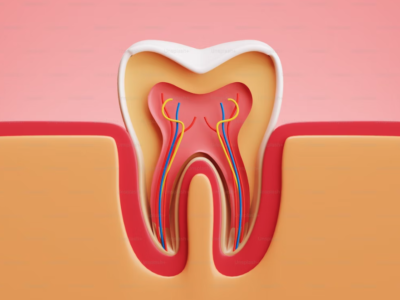 leczenie kanałowe w Szczecinie