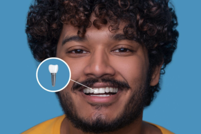 Protetyka dentystyczna w Szczecinie